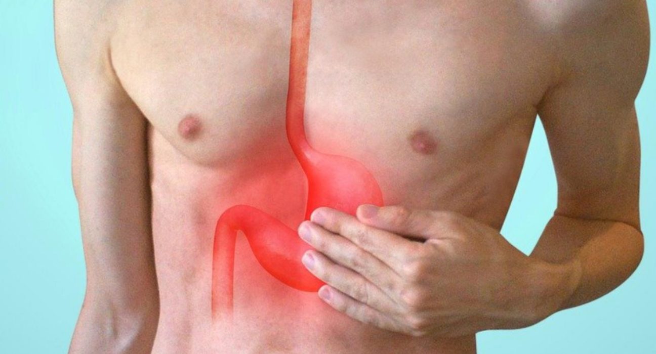 Metode naturale pentru ameliorarea refluxului gastric