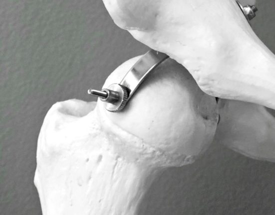 Primele simptome ale osteoporozei Semne alarmante si atentionari