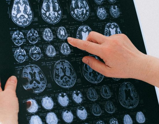 Afectiuni cerebrale tot mai frecvente in Romania Alerta medicala